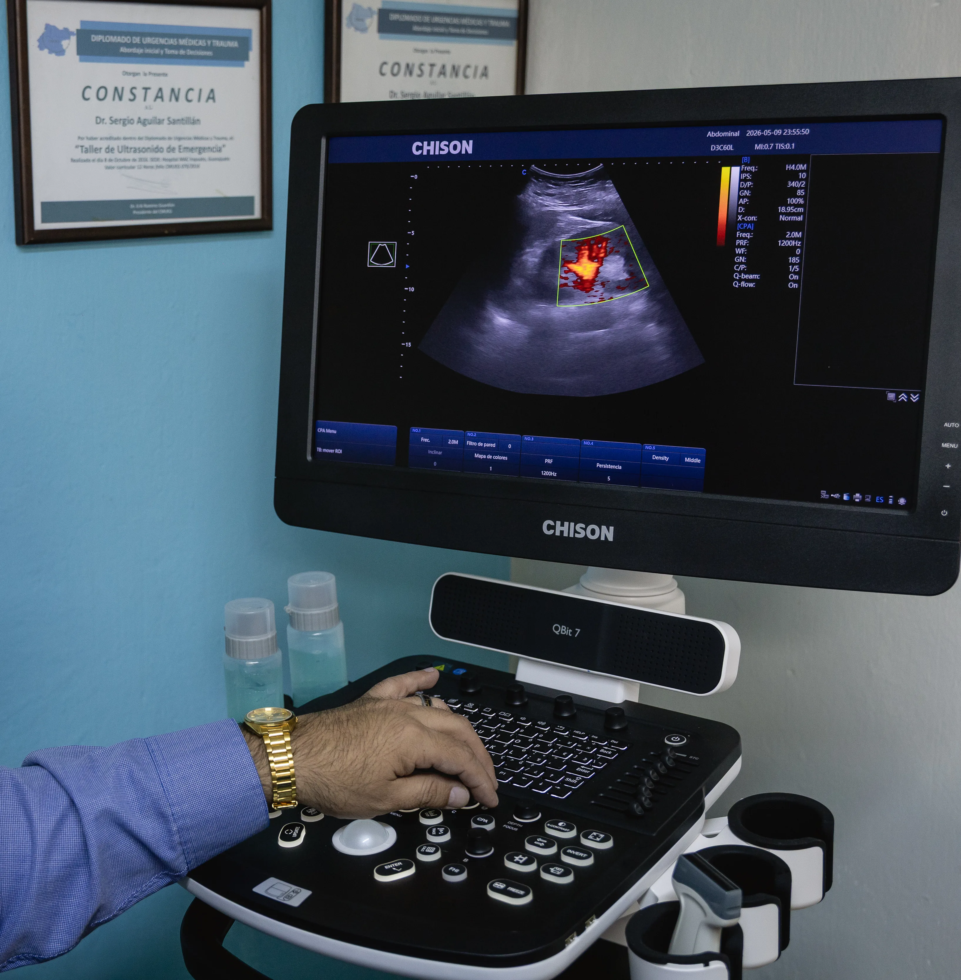 preguntas ultrasonografia irapuato gto